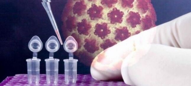 HPV greining með digene prófinu